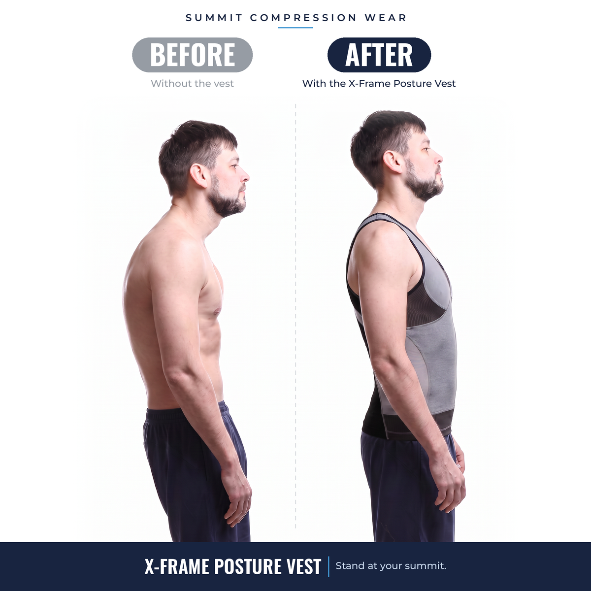 X-Frame Posture Vest β Stand Taller, Look Broader